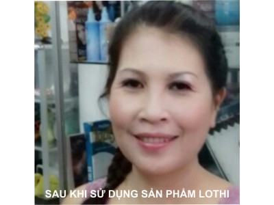 NGUYỄN KIM CHI, quận Gò Vấp, Tp. Hồ Chí Minh